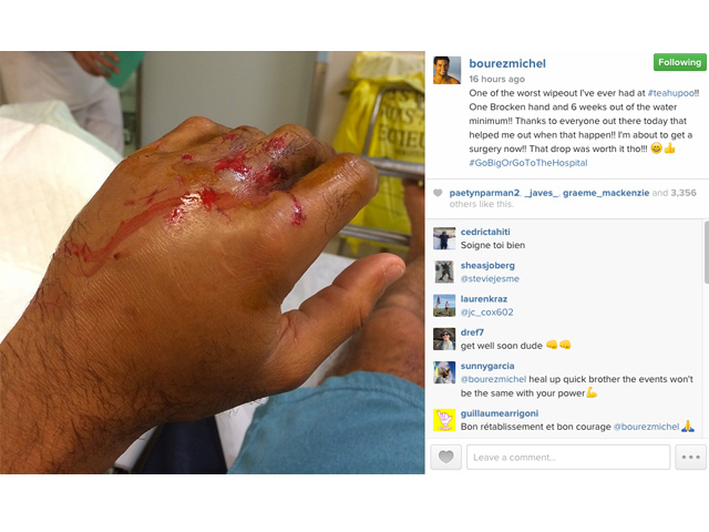 Click to enlarge image instagram-bourez-injured.jpg